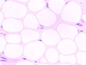 白色脂肪細胞